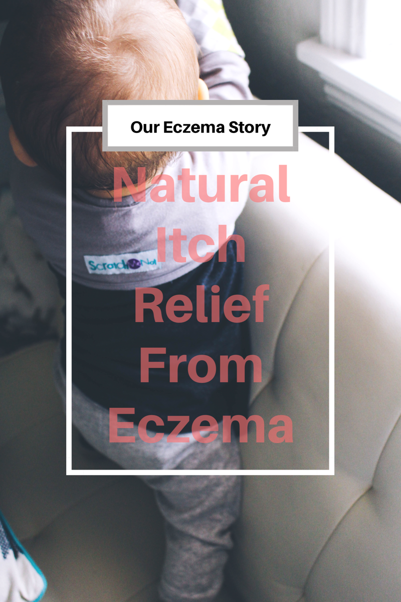 Natural Eczema Treatments & Itch Relief // Happily Lindsey blog